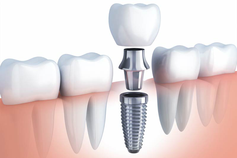 Dental Treatments in Easton